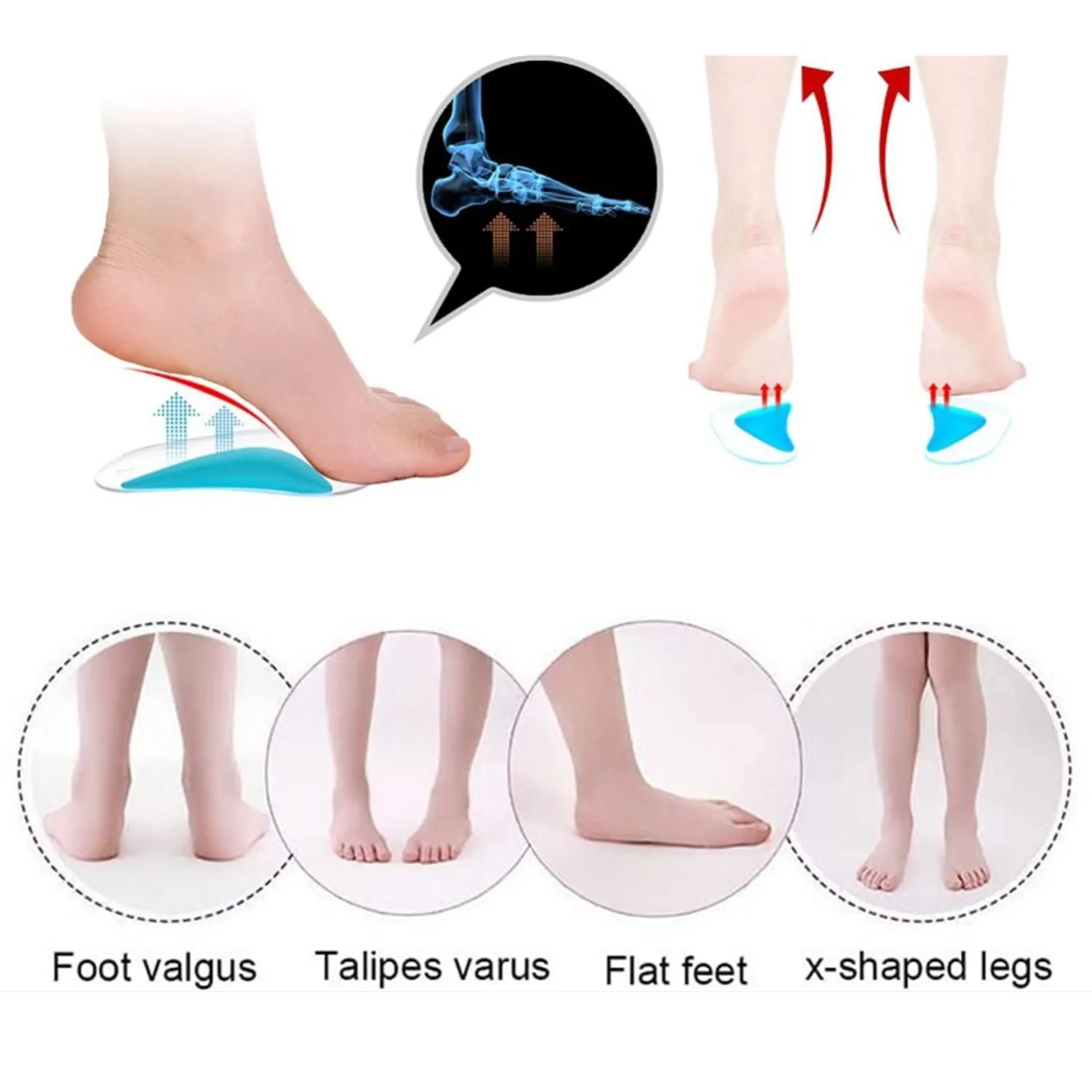 6 Pairs Arch Support Insoles, Silicone Flat Feet Plantar Fasciitis Orthotic Arch Insoles, Gel & Flannel Shoe Arch Support Cushion Pads for Women Men Kids by SamHeng
