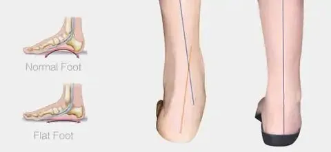 Premium Orthopedic Insoles